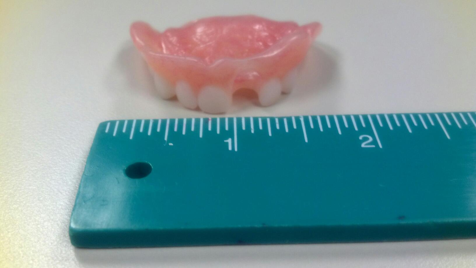 Keegan's little denture.