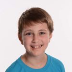 Boy affected by Goltz syndrome