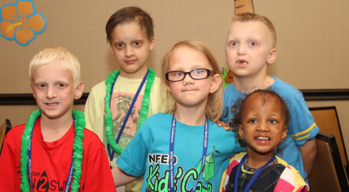 Children With Various Ectodermal Dysplasias