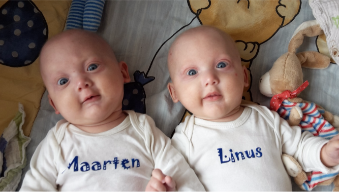 Babies With XLHED Treated In Utero NFED