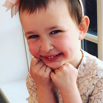 A young girl affected by HED caused by the WNT10A gene.