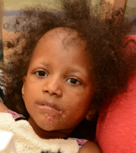 Girl with Goltz
