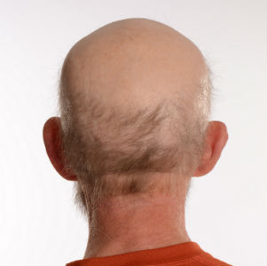 Man with EEC
