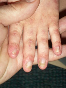 Unknown Nails