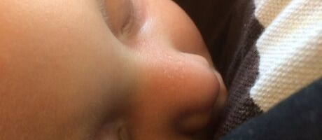 Sweat on a baby's nose
