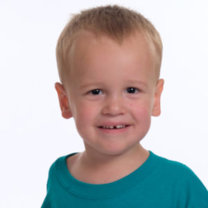 Alex Carroll is a toddler with OODD syndrome. This is caused by the WNT10A gene.