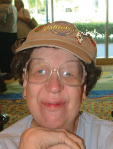Woman affected by trichorhinophalangeal syndrome, type 2 (TRPS2)