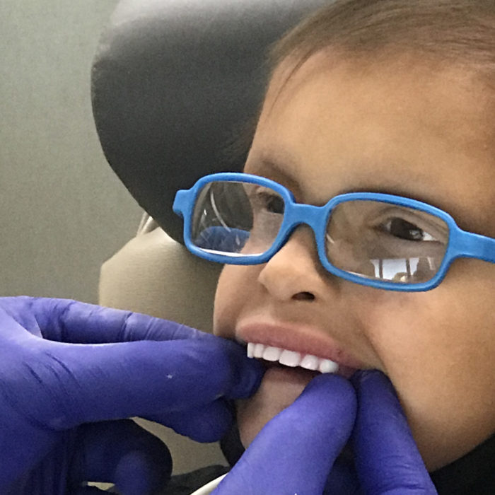 A child affected by XLHED sits in a dental chair while a dentist places his upper denture in the boy's mouth.