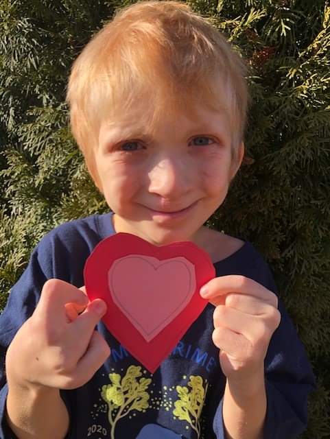 Ronan, affected by ectrodactyly-ectodermal dysplasia-clefting syndrome volunteering for the NFED.