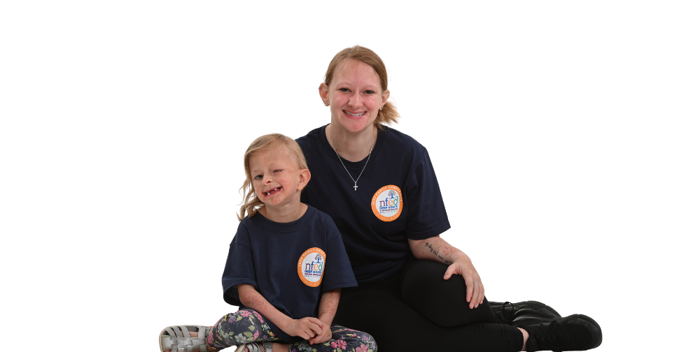 Girls affected by Goltz Syndrome, an ectodermal dysplasia