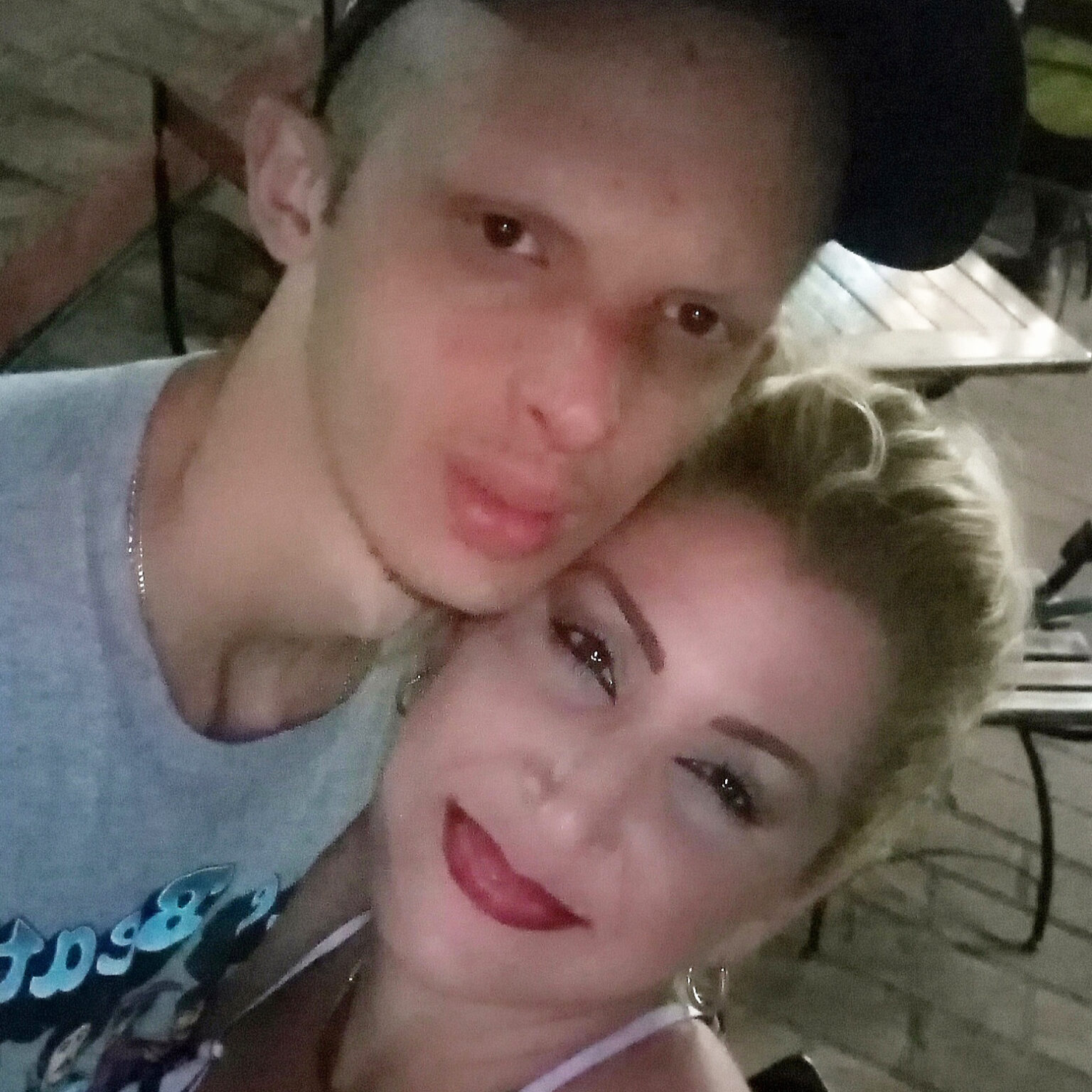 National Foundation for Ectodermal Dysplasias | NFED