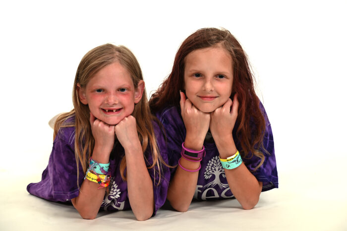 Two sisters affected by x-linked hypohidrotic ectodermal dysplasia lay on the ground with their hands under their chin. One girl is missing a few teeth.
