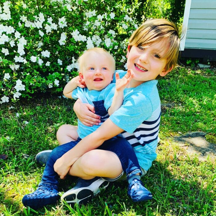 A boy in a blue shirt is holding his little brother who is affected by hypohidrotic ectodermal dysplasia. 
