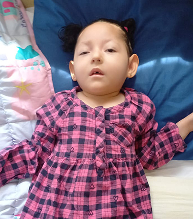 A baby girl with black hair in pony tails lays on a baby blanket. She's wearing a pink dress with black check. She's affected by incontinentia pigmenti.